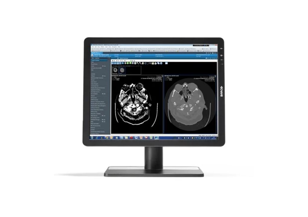 Medical Diagnostic Display Repair: Expert Service For Accurate Diagnostics